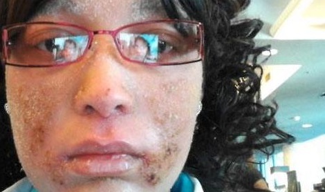 فتاة تغطي جسمها الأظافر بدلا من الشعر ! ( صور )